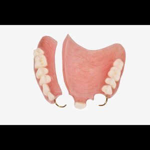 Camila prothetischemondzorg image 1