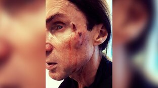 Zanger Robby Valentine in elkaar geslagen: "Uitgescholden voor zimmer en vieze flikker"