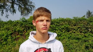 Scooterrijder die Lars hardhandig van fiets duwde meldt zich bij politie