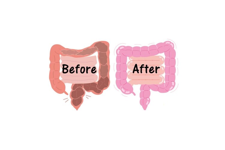 Doe aan preventieve zorg